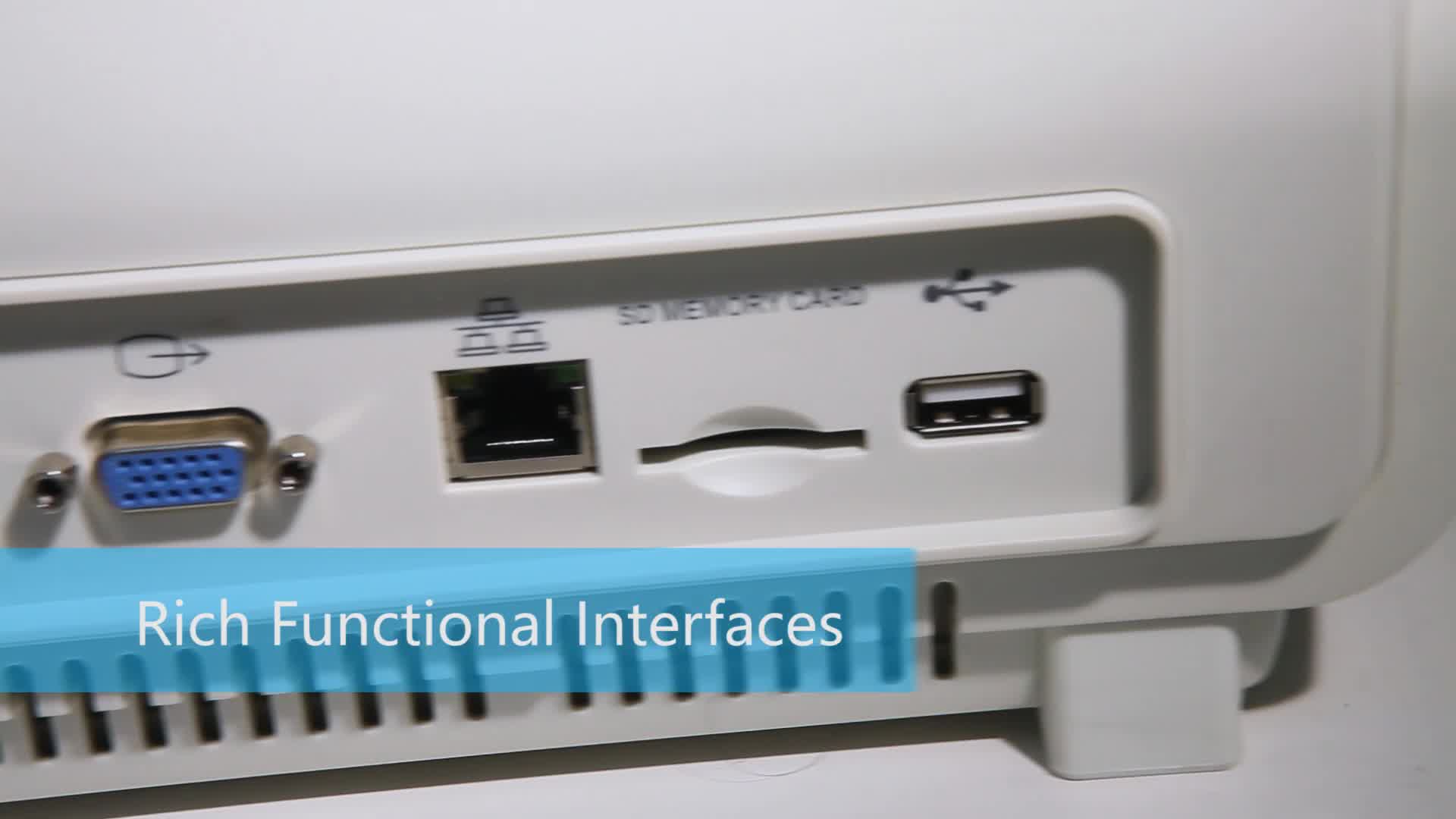 As a conventional bedside monitor in the hospital, Apollo N2 features a user-friendly interface and one-key shortcut operating model according to the features of more patients in the department and heavy workload for medical staff, saving more time and energy for medical workers