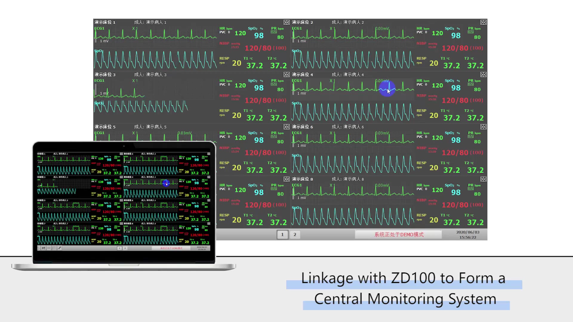 Features of iMD8 Transport Monitor