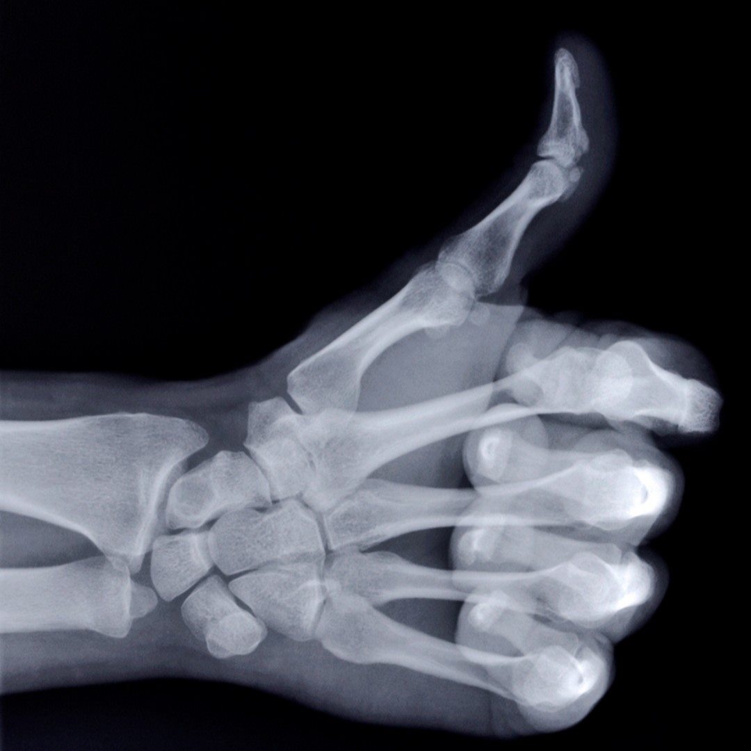 The “X” in “X-ray” stands for unknown. #FunFactFriday