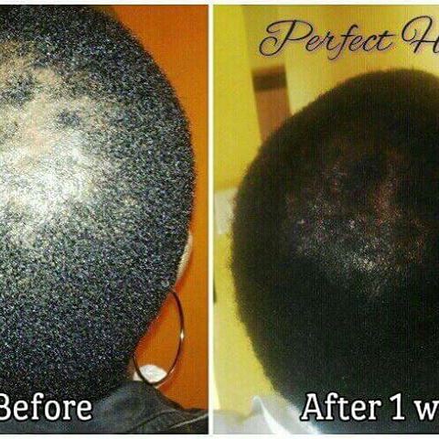 YOU'VE TRIED THE REST, NOW TRY THE BEST!!! Perfect Hair Grow: for thicker, longer, healthier hair – Accelerates Hair Growth Naturally. 